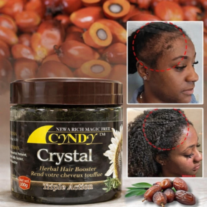 Huille de Cyndy crystal| L’huille de croissance des cheveux de traitement capillaire pour tous types de cheveux ulta bio et naturel